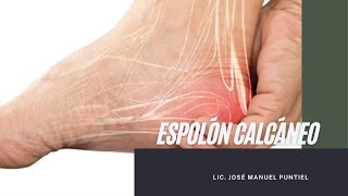 Espolón Calcáneo 🆘 Dolor en el talón  FisioterapiaRD [upl. by Enom]