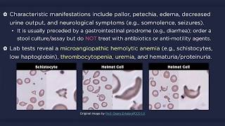 Hemolytic Uremic Syndrome HUS [upl. by Petrina]