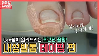 내성발톱 테이핑 방법 집에서 할수있는 초간단 발톱 tip ingrown toenail  toenail taping  Fresh Foot 성수점  남양주호평점 [upl. by Devland]