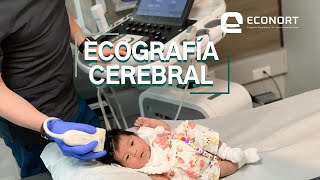 Ecografía cerebral a bebés Antofagasta [upl. by Nitsuj]