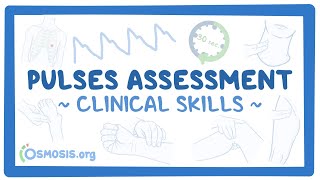 Clinical Skills Pulses assessment [upl. by Pilif]