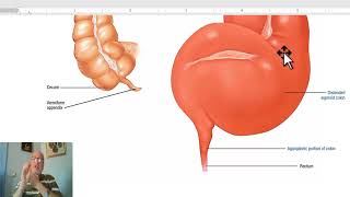 Paediatric surgery in Arabic 9  Hirschsprung’s Disease part 1  by Dr Wahdan [upl. by Nisen118]