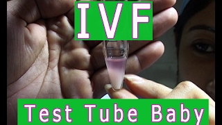 Test Tube Baby [upl. by Jaye295]