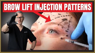 Botox Brow Lift Injection Patterns Botox MarkUp Tutorial [upl. by Marina240]