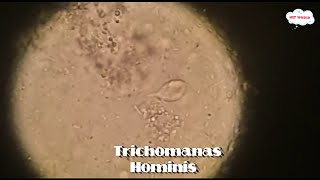 Trichomonas Hominis flagella Parasite in stool microscopystool parasite under microscope at 40X [upl. by Rourke]