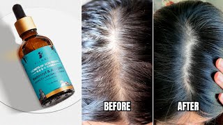 Pilgrim Redensyl amp Anagain Hair Serum For Hair Regrowth  Price Results Ingredients How To Apply [upl. by Tenney]