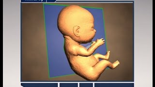 Step by Step to Get Perfect 3D4D Baby Image [upl. by Lemmueu]