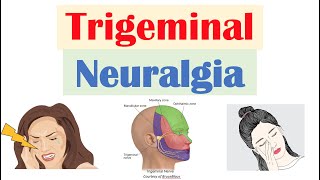 How to Reverse Peripheral Nerve Damage  The Nerve Doctors [upl. by Neneek]