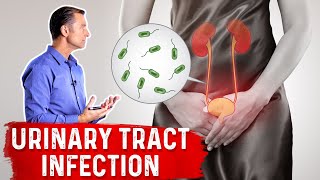 Top Natural Remedies for a UTI Urinary Tract Infection [upl. by Kazmirci171]