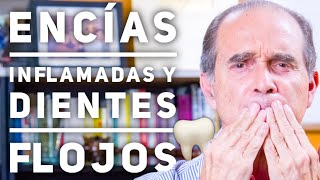 Episodio 1900 Encías Inflamadas Y Dientes Flojos [upl. by Haziza]