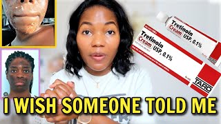 How To Stop Retinol Tretinoin Side Effects  Purging Darker skin Peelings Dryness More Acne [upl. by Leirraj]