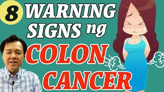 8 Warning Signs ng Colon Cancer  By Doc Willie Ong 1081 [upl. by Ecyle]