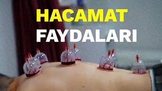 Hacamat Faydaları [upl. by Cody]