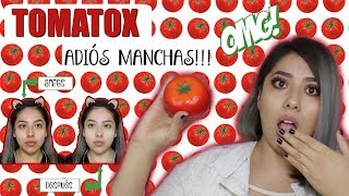 Reseña TOMATOX Aclara piel desde la PRIMERA VEZ l ADIÓS A LAS MANCHAS 💜 Esme Na [upl. by Baese629]