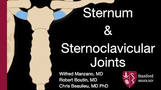 Sternum and Sternoclavicular Joints  Wilfred Manzano MD [upl. by Elimaj]