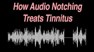 How Audio Notching Treats Tinnitus [upl. by Farron]