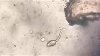 Schistosoma japonicum forktailed cercariae part 1 [upl. by Llebasi845]