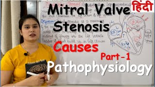 Mitral Valve Stenosis in Hindi  Definition  Causes Pathophysiology  Part1 [upl. by Ocirnor839]