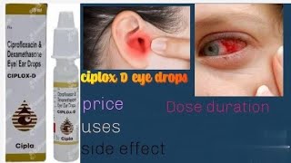 ciplox D eyes and ear drops ka istemal [upl. by Eimarrej]