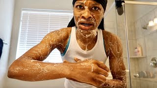 DISGUSTING SKIN PRANK ON ARMON AND TREY [upl. by Angelo]