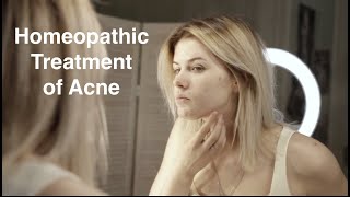 Best Homeopathy for Acne Homeopathic Treatment of Acne [upl. by Aciraj]