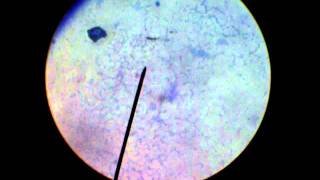 STAPHYLOCOCCUS EPIDERMIDIS SIMPLE STAINED [upl. by Ibbed316]