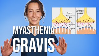 Myasthenia Gravis [upl. by Conah]