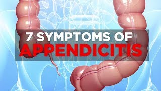 7 Symptoms of Appendicitis  Health [upl. by Alurd]