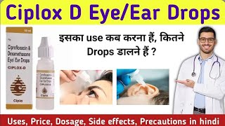 Ciplox d eye ear drops  Ciprofloxacindexamethasone eye ear drops ciplox d  Ciplox d eye drops [upl. by Giovanna]