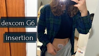 dexcom g6 insertion tutorial  laina elyse [upl. by Libbey608]