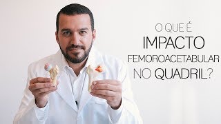 Impacto femoroacetabular uma das principais causas da artrose de quadril  Dr David Gusmão explica [upl. by Aeila371]