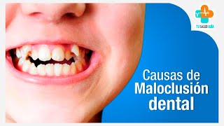 Causas de maloclusión dental  Tu Salud Guía [upl. by Aicilra860]