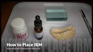 How to MixPlace IRM Intermediate Restorative Material [upl. by Harman]