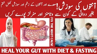 How To Improve Gut Health And Digestion Best And Worst Foods For Gut Health Listen Your Body [upl. by Rudolf]