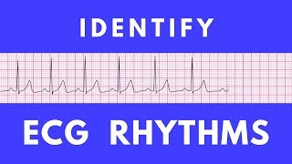 Identifying ECG rhythms  ACLS Precourse [upl. by Ennayhs]