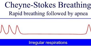 Cheyne Stokes Breathing Pattern  general diseases in human body Cheyne Stokes Kussmauls Biots [upl. by Clovah]