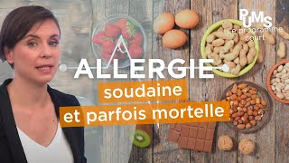 Reconnaître et éviter les allergies ALIMENTAIRES ou médicamenteuses  ŒDÈME DE QUINCKE [upl. by Elimay]