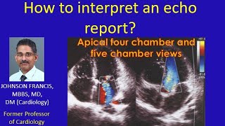 How to interpret an echo report [upl. by Bebe]