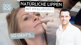 LIPPEN mit Hyaluron NATÜRLICH AUFSPRITZEN – so gehts – Dr Rolf Bartsch [upl. by Eleda]