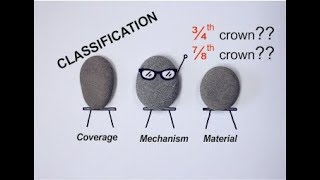 Classification of retainers FPD [upl. by Assirahc960]