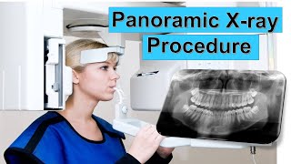 Panoramic Dental XRay Procedure EXPLAINED  PANORAMIC XRAY  Panoramic radiography OPG [upl. by Erdua]