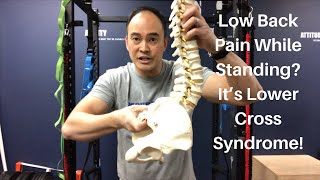 Low Back Pain While Standing It’s Lower Cross Syndrome [upl. by Sanjay]