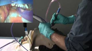 Jarvis Salad Intubation [upl. by Aneer]