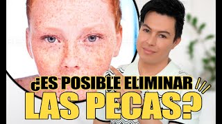 Cómo Eliminar Las Pecas de La Cara  Yasmany [upl. by Brenda234]