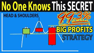 🔴 The Only quotHEAD amp SHOULDERSquot Trading Strategy You Will Ever Need 5 Easy Steps To BIG PROFITS [upl. by Aleakam]