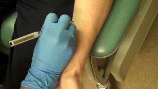 Allergy Testing Step 1 Skin Prick Testing [upl. by Yanad]