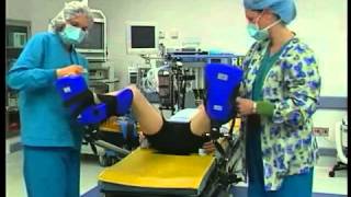 Lithotomy Positioning in Surgery [upl. by Arbmahs]