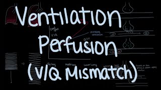 Ventilation and Perfusion Explained VQ Mismatch [upl. by Daniyal111]