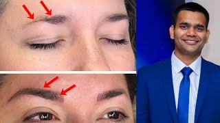 How To Grow Thicker Eyebrows Naturally and Faster  Dr Vivek Joshi [upl. by Noyk85]