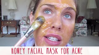 Homemade Honey Facial Mask For Acne  Cassandra Bankson [upl. by Eirellav]